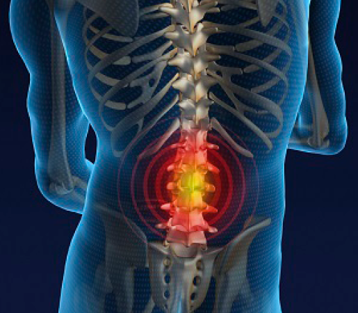 Evidence based care for lower back pain in primary setting | cpd4physios