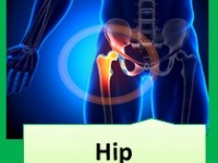 A graduate’s guide: The hip